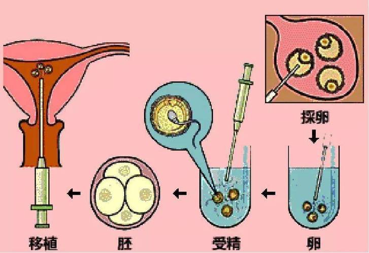 国内试管代怀怎么样【国内试管代怀怎么样?详细解读试管代怀孕流程及注意事项】